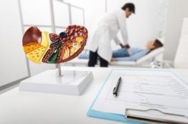 Foie : ce type de régime favorise le développement des cellules cancéreuses