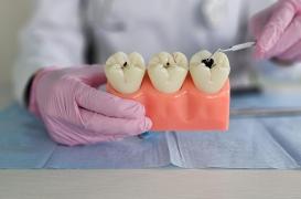 Cocaïne : quel impact sur la santé buccodentaire ? 