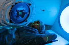 Radiothérapie : voici à quel moment de la journée, elle est le plus efficace