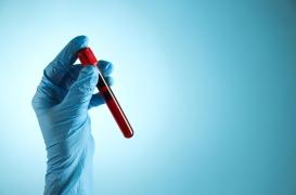 Alzheimer : une simple prise de sang peut-elle prédire la maladie ?