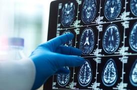 Troubles de la vision en avion : c’était une tumeur cérébrale