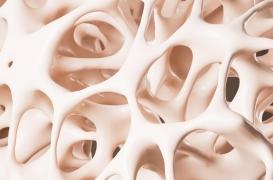 Cancer du sang : l’inflammation de la moelle osseuse pourrait expliquer son apparition 