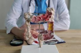 Ses symptômes cachaient un cancer colorectal de stade 4 
