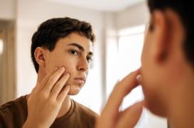 Looksmaxxing : jusqu'où certains jeunes sont-ils prêts à aller pour séduire ?