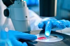 Traitement de la leucémie : la piste des combinaisons de médicaments