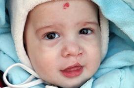 Décoder la génétique du visage pour réparer le bec de lièvre