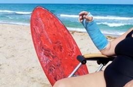 La chirurgie de l’obésité augmente le risque de fractures secondaires