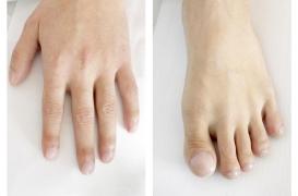 Hippocratisme digital : un signe à ne pas ignorer