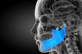 La première mâchoire imprimée en 3D greffée avec succès