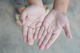 Doigts fripés dans l'eau : les plis de la peau ont toujours le même dessin 