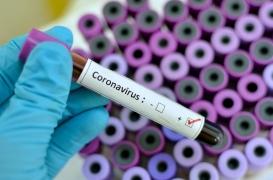 Coronavirus : le vaccin préparé par l’Institut Pasteur est un dérivé de la rougeole