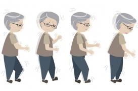 Parkinson : une application pour surveiller les symptômes à domicile et ajuster le traitement