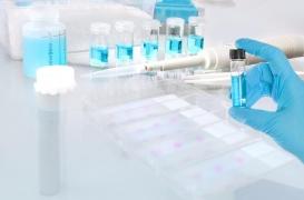 Les nouveaux mots du cancer : qu'est-ce que la biopsie liquide ?