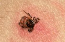 Maladie de Lyme: empoignade en France et nouvelles recommandations en Grande-Bretagne
