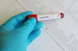 Légionellose en Suisse : quelle est l’origine de la contamination ?