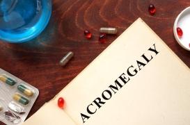 Atteinte d’une maladie rare, sa mâchoire et ses pieds 