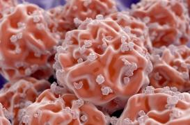 Syndrome myélodysplasique : un nouvel outil génétique pour ajuster au mieux le traitement