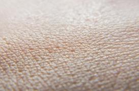 Nouvelle découverte sur la régénération des tissus après une grave brûlure