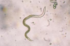 Chine : un ver de 30 cm découvert dans l’intestin d’une femme