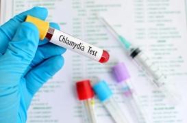 Chlamydia : un dépistage systématique de la MST recommandé pour les jeunes femmes