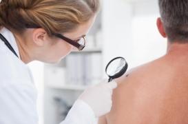 Mélanome : comment l’IA permet de le détecter de façon quasi-certaine