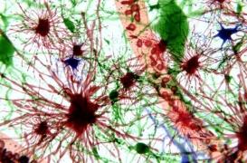 Première thérapie ciblée efficace contre les métastases du cerveau