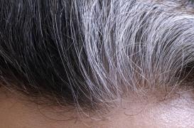 Vous avez des cheveux gris ? Cela refléterait une défense naturelle contre le risque de cancer