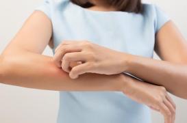 Des chercheurs découvrent un nouveau traitement contre les démangeaisons chroniques