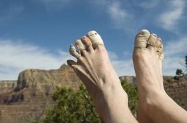 Les ampoules sont la rançon des premières randonnées après l’hiver, sauf si on les prévient.