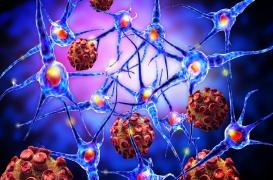 Journée mondiale : 6 idées fausses sur la sclérose en plaques