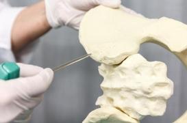 Paralysie : un traitement contre les maladies pulmonaires pourrait guérir les lésions de la moelle épinière