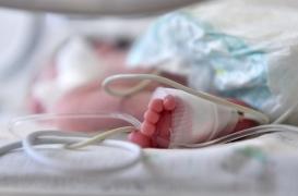 Le bébé le plus prématuré du monde vient de fêter son premier anniversaire