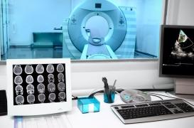 On peut vivre avec seulement la moitié d'un cerveau 