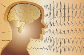 Les ultrasons pour détecter l’épilepsie plus tôt 