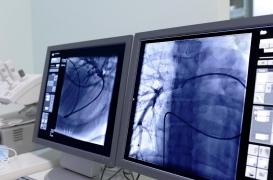 Maladies respiratoires : une technologie non invasive analyse le souffle des patients