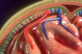 Les méninges… lorsqu’elles sont infectées… c’est la méningite !