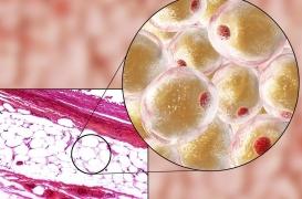 Contre la démence, l’effet protecteur de la graisse beige !