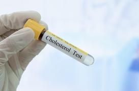 Cholestérol : les 4 pires aliments selon une cardiologue