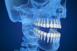 Douleur de la mâchoire à la mastication : le traitement est fonctionnel avant tout