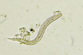 Deux hommes infectés par des vers après une greffe du rein