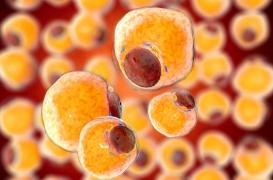 Cerveau : la graisse beige protège contre la démence