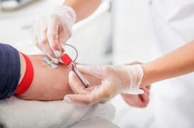 Cancer du poumon : un test de dépistage par prise de sang développé par le CHU de Nice