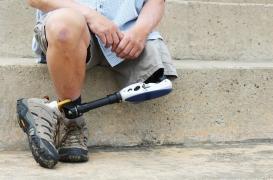 Dysphorie de l'identitié corporelle : un désir d'amputation lié à des anomalies dans la structure du cerveau 