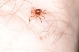 Un premier décès lié à une allergie à la viande causée par les tiques