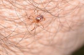 Morsure de tique : elle peut aussi provoquer des troubles digestifs