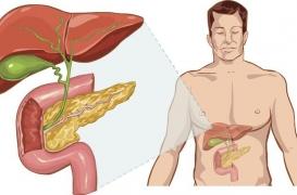 Cancer du pancréas : un nouveau test sanguin portatif et non coûteux pour le détecter