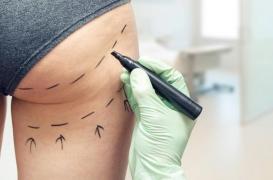 L'opération de chirurgie esthétique des fesses est la plus dangereuse