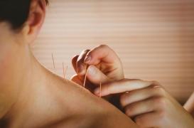 Ménopause : l’acupuncture peut réduire les bouffées de chaleur