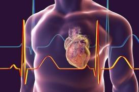 Fibrillation auriculaire : l'ablation par cathéter réduit les risques de décès et d'AVC