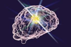 Cancer du cerveau : un nouveau traitement parvient à tuer les tumeurs les plus agressives